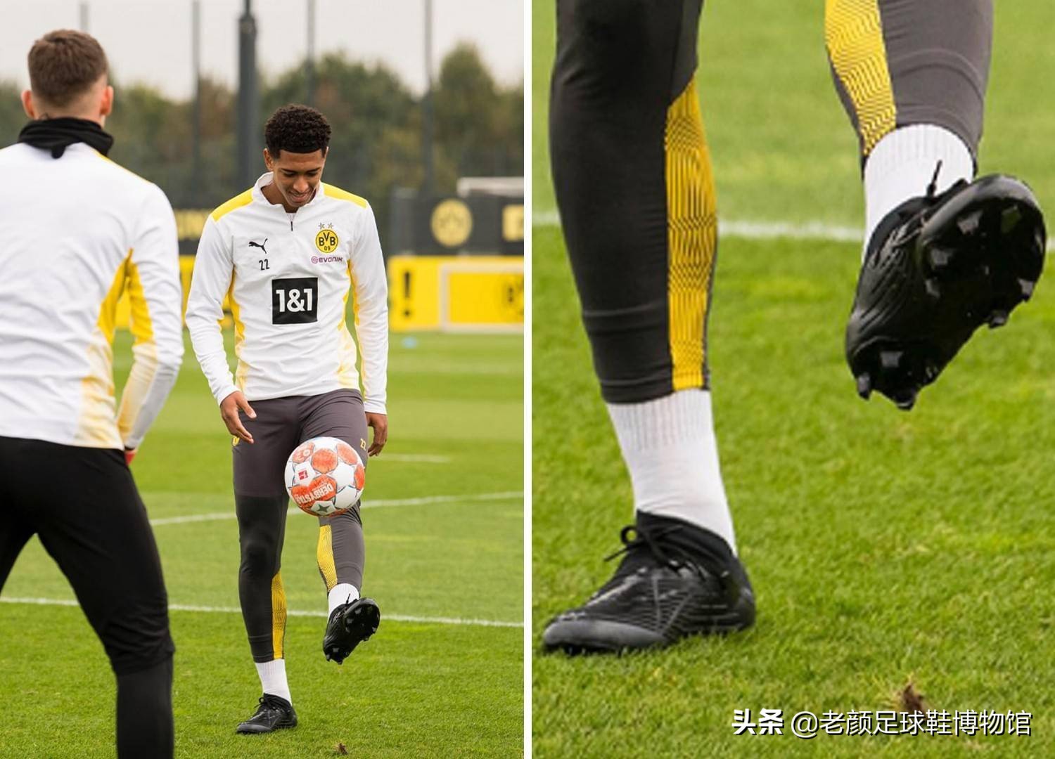 外球后的注 外球后的注